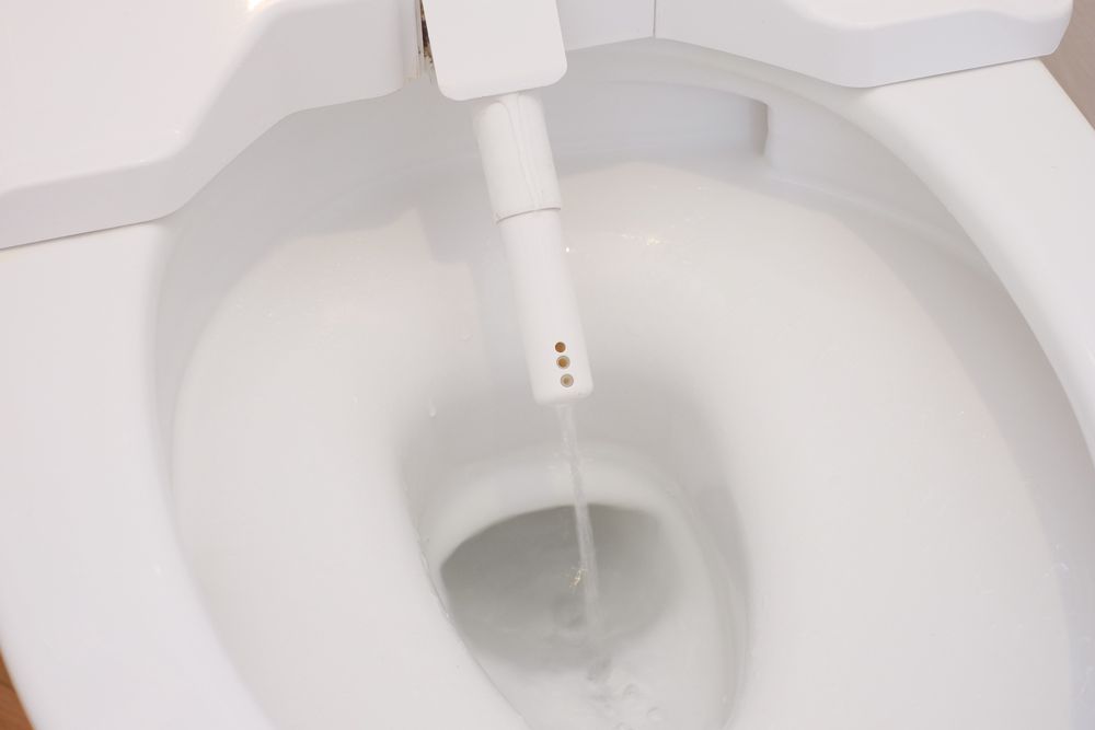 温水洗浄便座（ウォシュレットなど）付きトイレを修理する場合の業者選びと費用目安