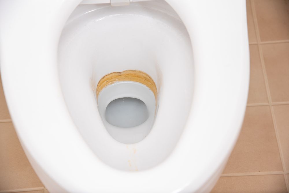 便器・便座が黄ばむ原因と放置するリスク
