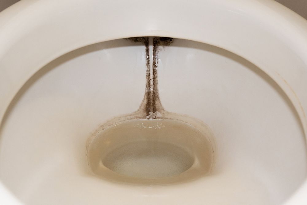 トイレの黒ずみを落とす方法は?落ちないときの対処法も解説