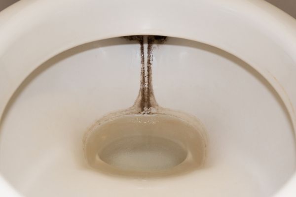 トイレの黒ずみを落とす方法は？落ちないときの対処法も解説